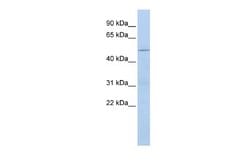 CECR6 Rabbit anti-Human, Polyclonal, Novus Biologicals 0.1 mL | Buy Online | Novus Biologicals | Fisher Scientific